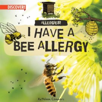 I_Have_a_Bee_Allergy