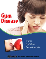Gum_Disease